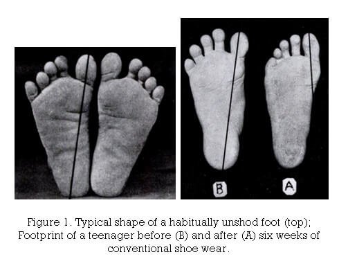 Running Barefoot vs. Shoes